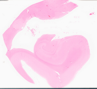 ['deident_174cbeeb-8dfd-4017-9876-c0556f51abd6_69d96a1e.jpg']