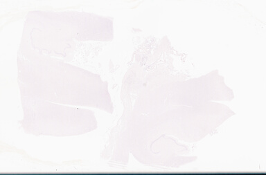 ['deident_d675a071-9752-4da7-a3be-f9858b88422f_69d96a7a.jpg']