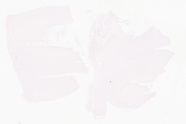 ['deident_1b17b421-f158-4a49-a1df-d43fa68d66b1_69d96a25.jpg']