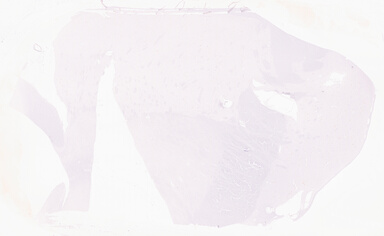['deident_a930ebae-8f25-4b54-9515-4fbf400dbbd4_69d96a6d.jpg']