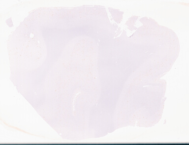 ['deident_e72bdbd1-7726-421d-a96e-d52344925c50_69d96a82.jpg']