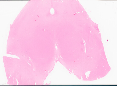 ['deident_86f3d3c8-f7b5-4bff-ad91-f96e5fec79dc_69d96a5d.jpg']