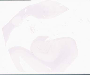 ['deident_99dce206-7b1b-4643-b400-e60382bf8619_69d96a68.jpg']