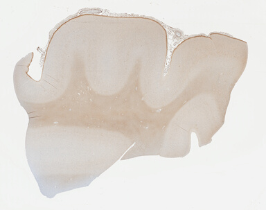 ['deident_b5d7d88c-2299-49c1-b071-a499111525d3_695fc330.jpg']