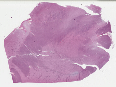 ['deident_253dd4ae-068c-4614-9f92-9c35c47d4255_695fc2ea.jpg']