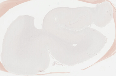 ['deident_c4edad05-e0ce-4cc2-99fe-9d05de6d3b6f_695fc333.jpg']