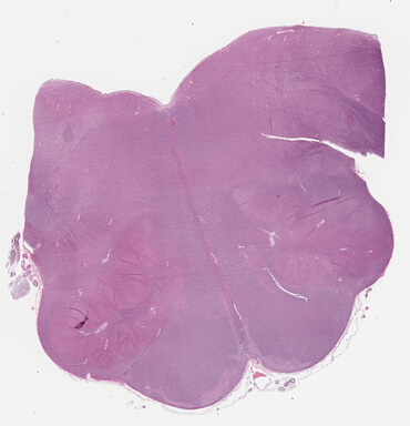 ['deident_1c8b5ddc-fd76-4d6d-befc-23dc10203059_695fc2e5.jpg']