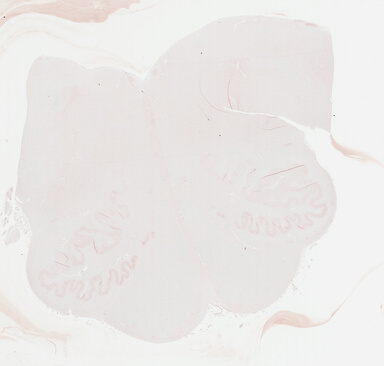 ['deident_c72a2ad5-079e-474d-b085-3ca3d935aeac_695fc335.jpg']