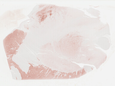 ['deident_4e39106f-ab7b-44fb-b3a8-120ad4eb7486_695fc2fe.jpg']