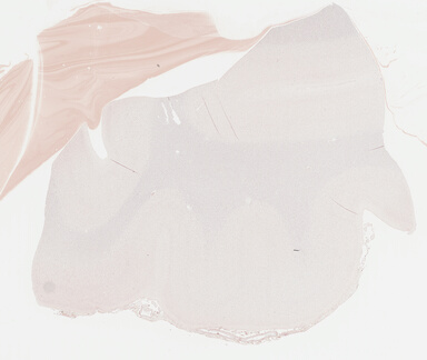 ['deident_5785fb7d-0710-4eeb-af0d-a7615ee0f6f3_695fc303.jpg']