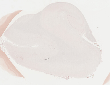['deident_a1dfab28-38c7-4477-b2fa-dcc2457e0ea4_695fc323.jpg']