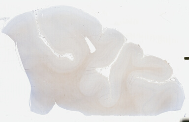 ['deident_6da84a2d-d5d4-4489-b509-364218f5ffaa_695fc30b.jpg']