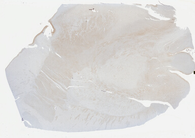 ['deident_6e461994-54d2-4e37-935f-0a97b2485df6_695fc30e.jpg']