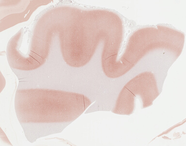 ['deident_70f9d6a5-ab43-4251-a857-a40bd48c7370_695fc310.jpg']