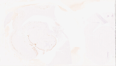 ['deident_bccc2fb0-09d6-4047-886b-ec898ea84cb5_69d96019.jpg']