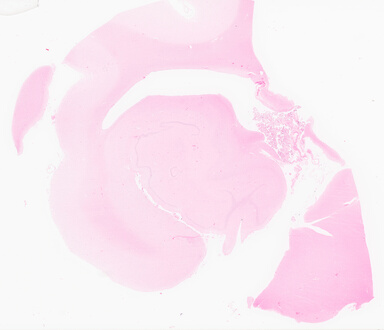['deident_47863ed7-b8ab-4cb4-8851-c5ce930a9e08_69d95fda.jpg']