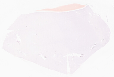 ['deident_3808dfd0-3fc0-491a-94ad-5cbeed2811fe_69d95fd4.jpg']
