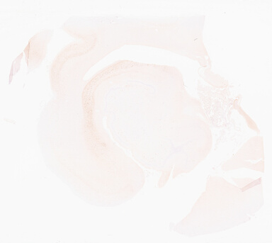 ['deident_12dd5b87-bebe-4d79-bf64-98a374070b43_69d95fc3.jpg']