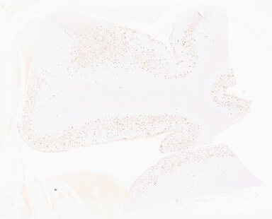 ['deident_a0037a60-000b-4d8a-ac82-3a5efbda205c_69d96009.jpg']