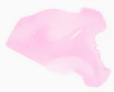 ['deident_8f008baa-3479-402d-ad41-f45cd080ce17_69d95ffd.jpg']