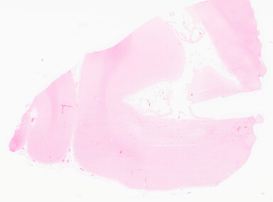 ['deident_0851b9d7-09b0-4bb4-80cf-71ff7644b252_69d95fbc.jpg']