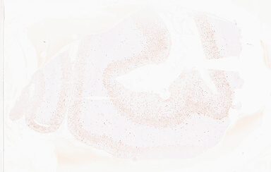 ['deident_0045527b-0362-4af4-9ce4-6d044a7a805d_69d95f82.jpg']