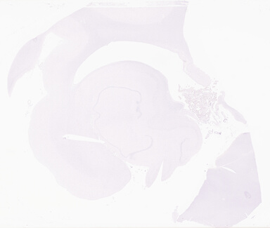 ['deident_c2e4e11c-3e53-4b12-9d27-523a9360df58_69d9601f.jpg']