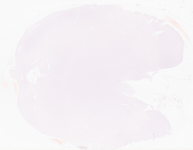 ['deident_573392b3-9f03-4c8d-ae23-f4d640f46dd5_69d95fe7.jpg']