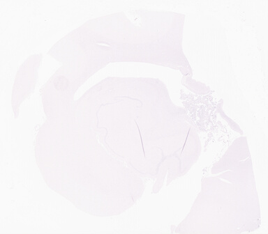 ['deident_701f80ee-cbb6-43ee-bfda-a9a784286bdb_69d95fee.jpg']