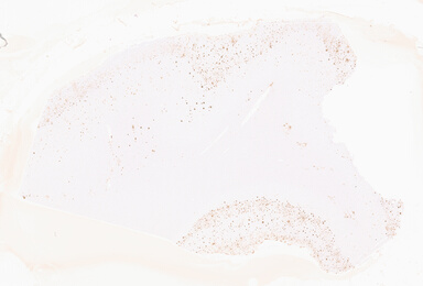 ['deident_6ee44a9e-48e2-4ba9-af26-67f46158466d_69d95fed.jpg']