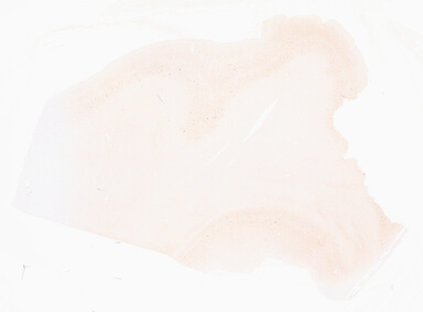 ['deident_6e47d446-f2f2-4222-9939-9618ad88d2f4_69d95fe9.jpg']