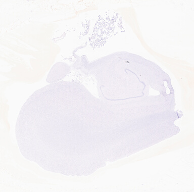 ['deident_f2e8ed1d-994d-4a99-9fdd-bb17e410f5d7_69d96038.jpg']