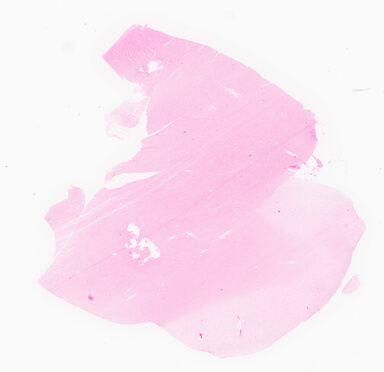 ['deident_04be16c5-62b4-4e18-9082-9b7ac420218d_69d95f84.jpg']