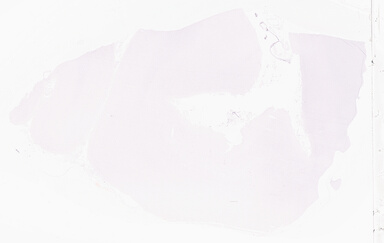 ['deident_a135c6b3-5d9c-44d4-ba8c-db1ace445fc5_69d9600c.jpg']