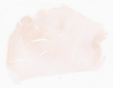 ['deident_a0992316-d2ec-44e6-bb63-59dcbbe27881_69d9600b.jpg']
