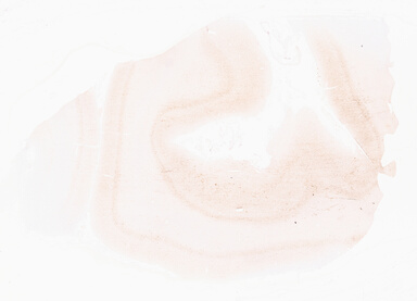 ['deident_f4dde0bc-5efb-4e2e-8239-738d1d14e802_69d9603d.jpg']