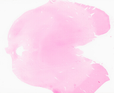 ['deident_b600fda4-a2ec-4eb9-b6a7-74052d75f371_69d96017.jpg']