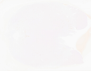 ['deident_38bf29b3-81db-416e-b2a0-bd4fcf2b45ae_69d95fd6.jpg']
