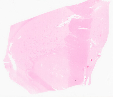 ['deident_ab9b1157-e41e-4890-b547-b97bdbe3a9ae_69d96011.jpg']