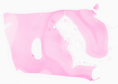 ['deident_7fbaaa60-17b4-43fa-b9ad-cfb77b0cdeba_69d95ff9.jpg']