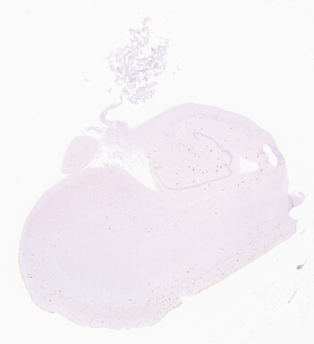 ['deident_7c58d517-bc3d-410f-828d-28adc56b9832_69d95ff3.jpg']