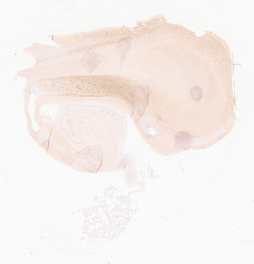 ['deident_2d31d762-45eb-4b85-b045-289a6a1ca066_69d95fd0.jpg']