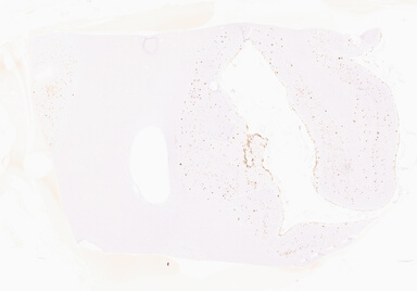 ['deident_c869a21f-927e-49fa-a9ec-9f607cb4403f_69d96020.jpg']