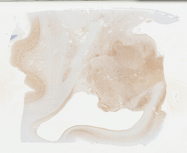 ['deident_54a32583-41e5-44ea-ace9-a3b6f2977507_69b04af4.jpg']