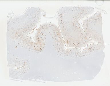['deident_ef7fb2ca-4dfe-467f-84e6-3a9898bf63d8_69b04b30.jpg']