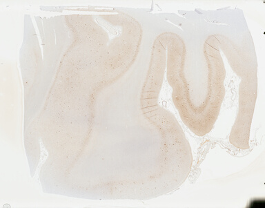 ['deident_7d191f8e-f634-40ed-9638-747119b5a90a_69b04b09.jpg']