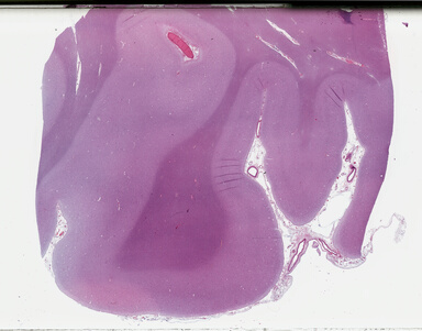 ['deident_218bef2d-6a8a-49e3-8cf6-c08a5251875d_69b04ae0.jpg']