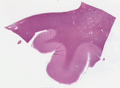 ['deident_d3ff7a57-c90b-4577-8ca1-ffbacac5ccbb_695fc7ae.jpg']