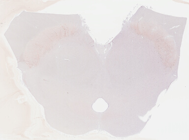 ['deident_ac29f0a4-3e3b-4544-a98c-8e2a8b4e7da1_695fc7a9.jpg']