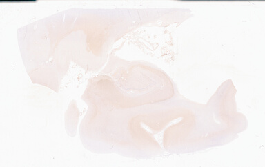 ['deident_b6816813-ed3b-478e-b148-e7694b0f8eba_69b0588c.jpg']